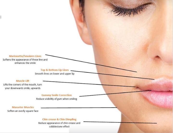 Cosmetic Facial Injectables